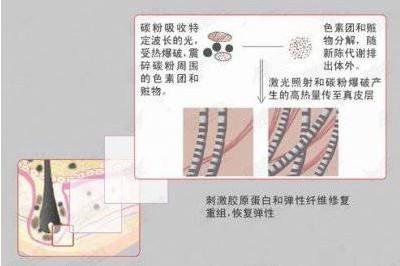 黑脸娃娃手术方式